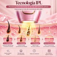 Tecnología IPL